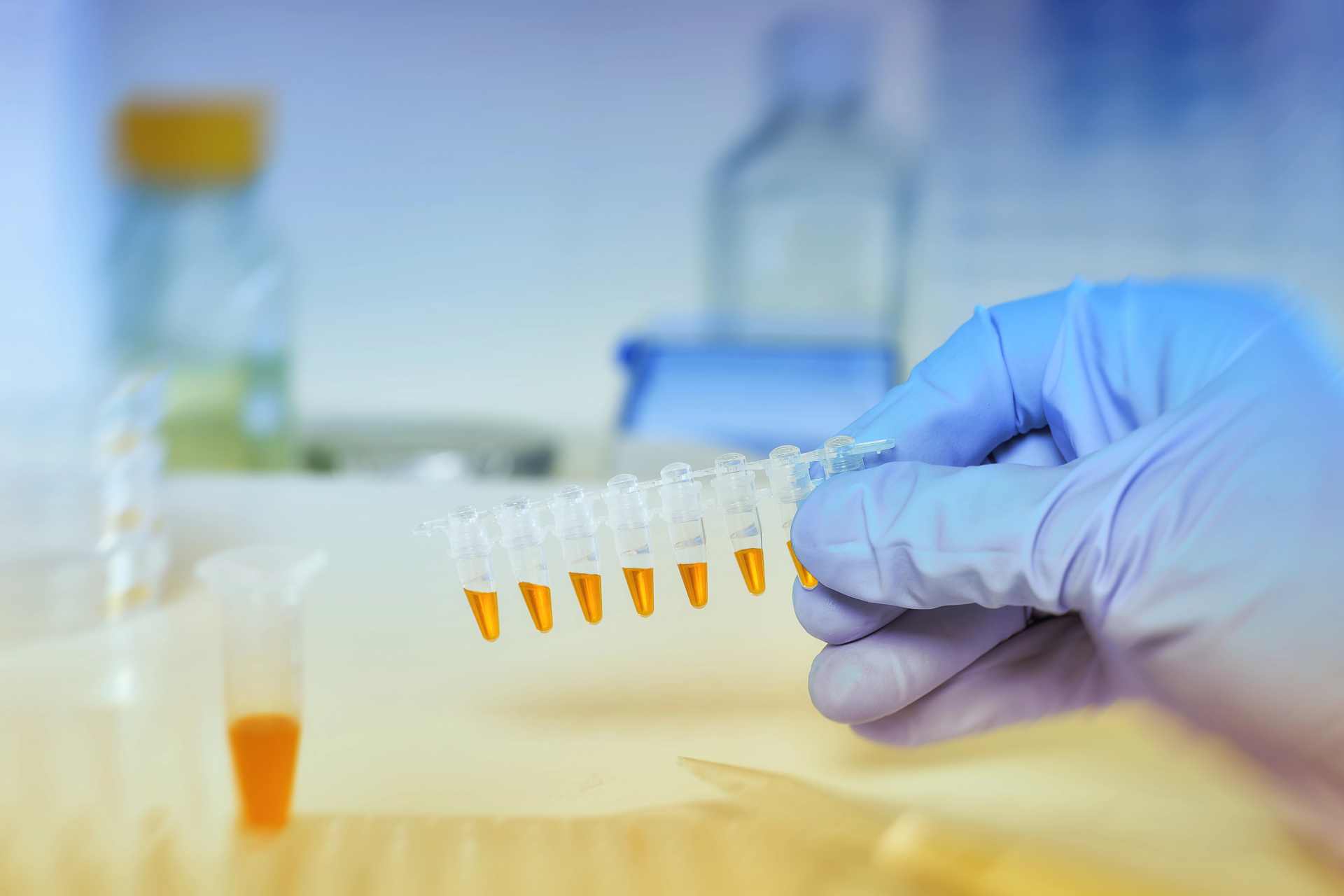 Laboratory vials containing urine samples lined up for testing, highlighting the need for glyphosate exposure monitoring.