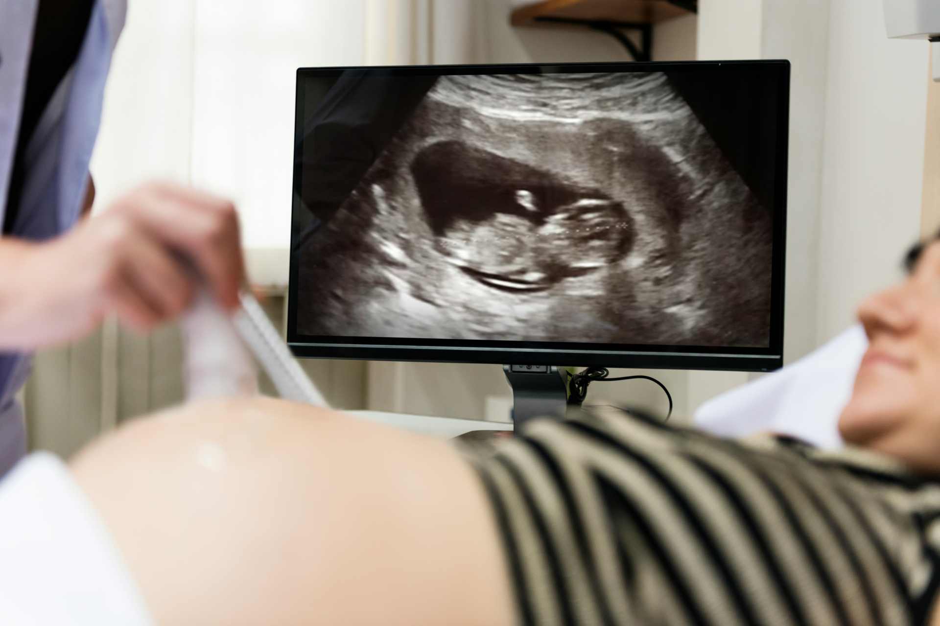 Pregnant woman undergoing an ultrasound scan, with the baby visible on the monitor — symbolising how glyphosate exposure can begin before birth.