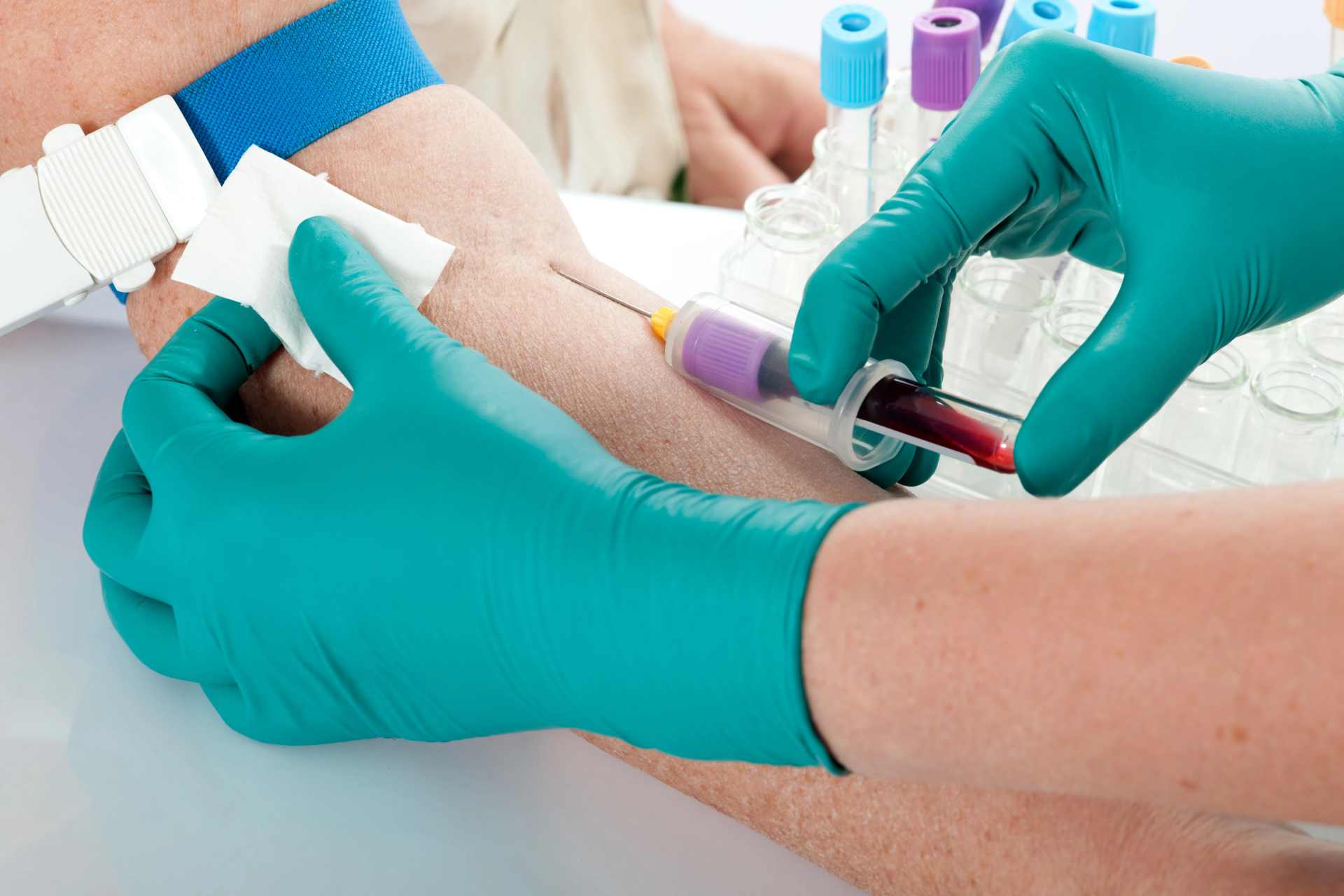 Close-up of a blood sample being taken during laboratory testing linked to research into glyphosate exposure, metabolomics, and early biological warning signs in the human body.